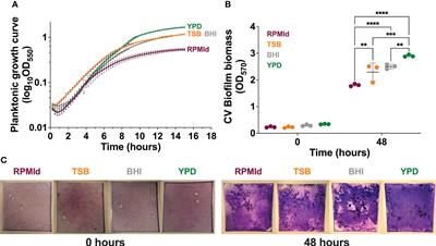 Culture media influences Candida parapsilosis growth, susceptibility, and virulence